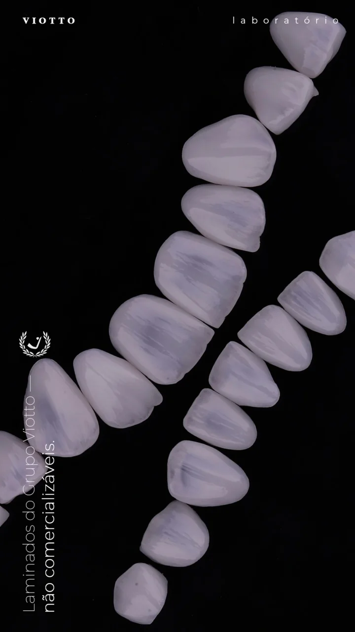 Detalhe clínico de lentes de contato dental