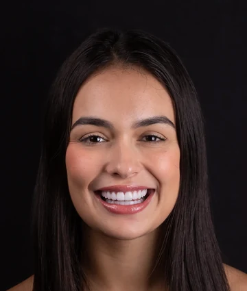 Resultado odontológico apresentado pela Clínica Viotto Belo Horizonte