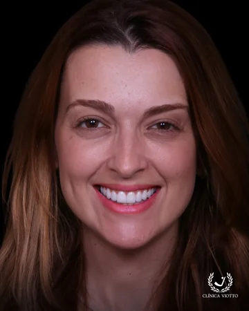 Sorriso de paciente da Clínica Viotto