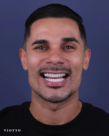Sorriso de paciente da Clínica Viotto