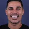 Sorriso de paciente da Clínica Viotto
